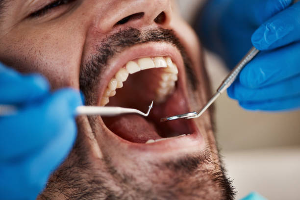 Best Emergency Cosmetic Dentistry (e.g., broken veneers) in Teays Valley, WV