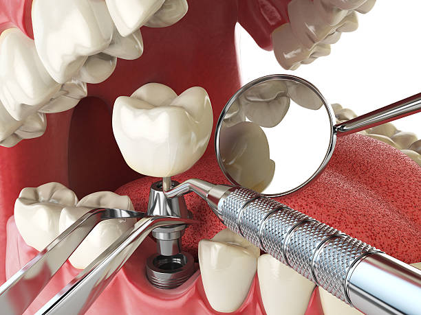 Best Emergency Care for Gum Disease in Teays Valley, WV